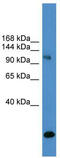 Ubiquitin carboxyl-terminal hydrolase 8 antibody, TA342558, Origene, Western Blot image 