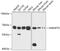 Small Nuclear Ribonucleoprotein U1 Subunit 70 antibody, GTX65948, GeneTex, Western Blot image 