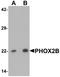 Paired Like Homeobox 2B antibody, A02221, Boster Biological Technology, Western Blot image 