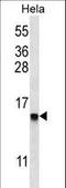 Defensin Beta 112 antibody, LS-C167350, Lifespan Biosciences, Western Blot image 
