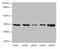 Uncoupling Protein 3 antibody, CSB-PA025556LA01HU, Cusabio, Western Blot image 