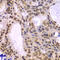 DNA polymerase delta subunit 3 antibody, LS-C346302, Lifespan Biosciences, Immunohistochemistry paraffin image 