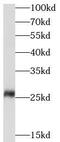 Glutathione S-Transferase Mu 1 antibody, FNab09906, FineTest, Western Blot image 