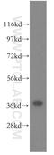 Zic Family Member 4 antibody, 51003-1-AP, Proteintech Group, Western Blot image 
