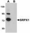 Sushi Repeat Containing Protein X-Linked antibody, LS-B5049, Lifespan Biosciences, Western Blot image 