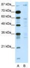 DNA Methyltransferase 1 Associated Protein 1 antibody, TA345266, Origene, Western Blot image 