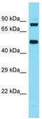 Kelch Repeat And BTB Domain Containing 6 antibody, TA337369, Origene, Western Blot image 