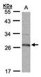 15-Hydroxyprostaglandin Dehydrogenase antibody, LS-B11719, Lifespan Biosciences, Western Blot image 