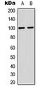 Glutamate Ionotropic Receptor AMPA Type Subunit 2 antibody, LS-C356073, Lifespan Biosciences, Western Blot image 