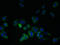 Low Density Lipoprotein Receptor Class A Domain Containing 1 antibody, orb31442, Biorbyt, Immunocytochemistry image 
