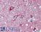 CDGSH Iron Sulfur Domain 1 antibody, LS-B15585, Lifespan Biosciences, Immunohistochemistry paraffin image 