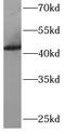 ADP-ribosylation factor GTPase-activating protein 1 antibody, FNab10028, FineTest, Western Blot image 