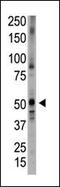 Bone Morphogenetic Protein 5 antibody, PA5-11718, Invitrogen Antibodies, Western Blot image 