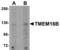 Anoctamin 1 antibody, TA306852, Origene, Western Blot image 