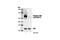 Protein Tyrosine Kinase 2 antibody, 3281P, Cell Signaling Technology, Western Blot image 