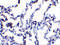 Ribonucleotide Reductase Regulatory TP53 Inducible Subunit M2B antibody, 2383, ProSci, Immunohistochemistry paraffin image 