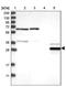 Enoyl-CoA Hydratase Domain Containing 2 antibody, PA5-55398, Invitrogen Antibodies, Western Blot image 