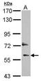DEP Domain Containing 7 antibody, GTX117979, GeneTex, Western Blot image 