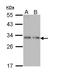 Proenkephalin-B antibody, LS-C186308, Lifespan Biosciences, Western Blot image 
