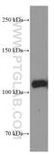 Low Density Lipoprotein Receptor antibody, 66414-1-Ig, Proteintech Group, Western Blot image 