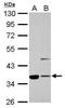 Annexin A2 antibody, GTX100046, GeneTex, Western Blot image 
