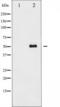CREB2 antibody, TA325233, Origene, Western Blot image 
