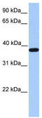 Actin Related Protein T2 antibody, TA340236, Origene, Western Blot image 