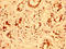 Epithelial Splicing Regulatory Protein 2 antibody, LS-C672109, Lifespan Biosciences, Immunohistochemistry paraffin image 