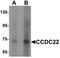 Coiled-Coil Domain Containing 22 antibody, TA319898, Origene, Western Blot image 