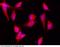Eukaryotic Translation Initiation Factor 4E Binding Protein 1 antibody, 10022-R007, Sino Biological, Immunohistochemistry paraffin image 