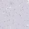 Ribonuclease A Family Member 3 antibody, HPA056183, Atlas Antibodies, Immunohistochemistry frozen image 