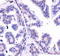 Dicer 1, Ribonuclease III antibody, TA309626, Origene, Immunohistochemistry paraffin image 