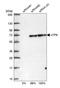 UTP6 Small Subunit Processome Component antibody, HPA025936, Atlas Antibodies, Western Blot image 