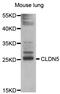 Claudin 5 antibody, abx125681, Abbexa, Western Blot image 