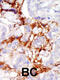 P21 (RAC1) Activated Kinase 3 antibody, 63-292, ProSci, Immunohistochemistry paraffin image 