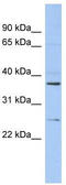 Zinc Finger AN1-Type Containing 6 antibody, TA335509, Origene, Western Blot image 