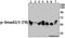 SMAD2 antibody, A00090T8, Boster Biological Technology, Western Blot image 