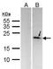 Dual Specificity Phosphatase 14 antibody, GTX104711, GeneTex, Western Blot image 