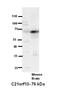 Lebercilin LCA5 Like antibody, A17743, Boster Biological Technology, Western Blot image 