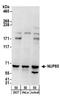Nucleoporin 85 antibody, A303-977A, Bethyl Labs, Western Blot image 