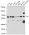 GC Vitamin D Binding Protein antibody, A5709, ABclonal Technology, Western Blot image 
