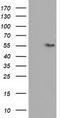 Thromboxane A Synthase 1 antibody, CF501379, Origene, Western Blot image 
