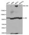 ABL Proto-Oncogene 1, Non-Receptor Tyrosine Kinase antibody, abx000665, Abbexa, Western Blot image 