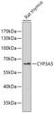 Cytochrome P450 Family 2 Subfamily J Member 2 antibody, A00530, Boster Biological Technology, Western Blot image 