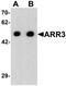 Arrestin 3 antibody, TA326702, Origene, Western Blot image 