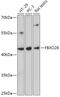 F-Box Protein 28 antibody, 18-030, ProSci, Western Blot image 