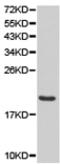 CD70 Molecule antibody, TA321314, Origene, Western Blot image 