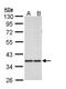 Aldo-Keto Reductase Family 1 Member B10 antibody, PA5-22036, Invitrogen Antibodies, Western Blot image 