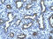 E3 ubiquitin-protein ligase TRIM13 antibody, ARP34143_P050, Aviva Systems Biology, Immunohistochemistry paraffin image 