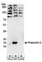AD4 antibody, A304-342A, Bethyl Labs, Western Blot image 